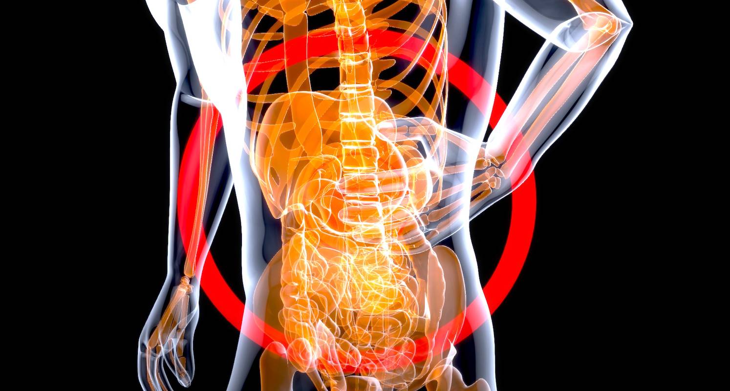 골반통증xray